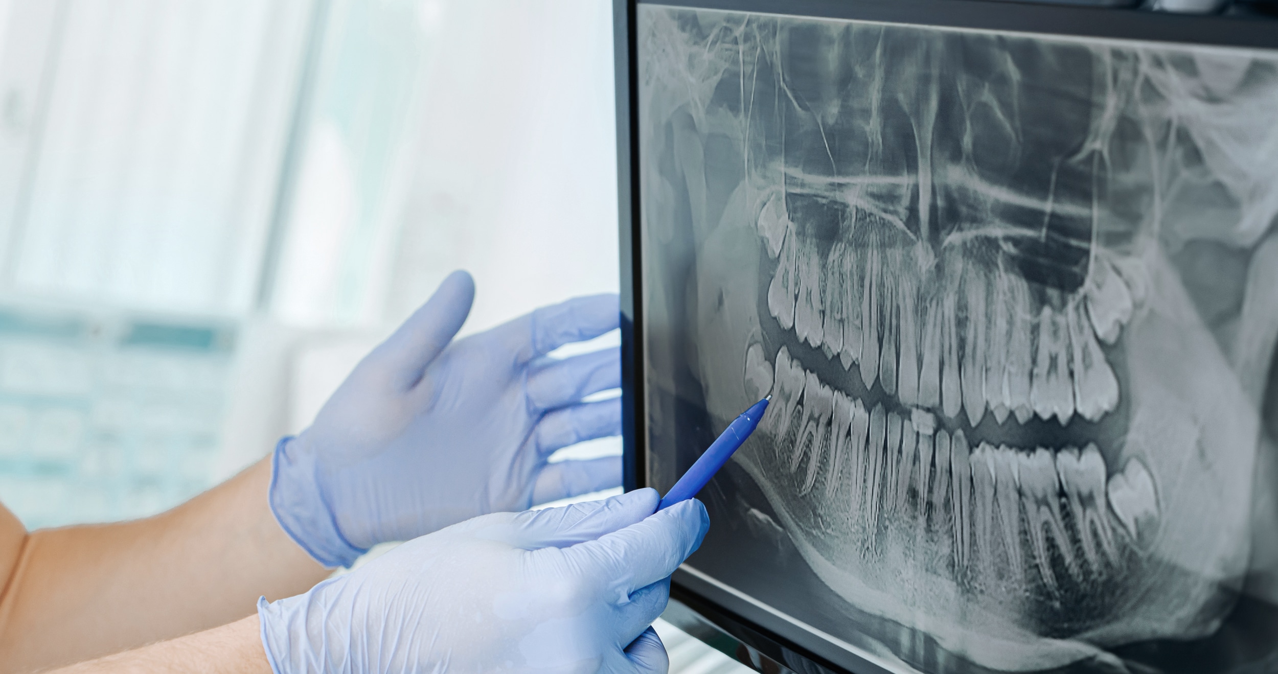 Child getting eye exam